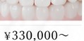 セラミック矯正